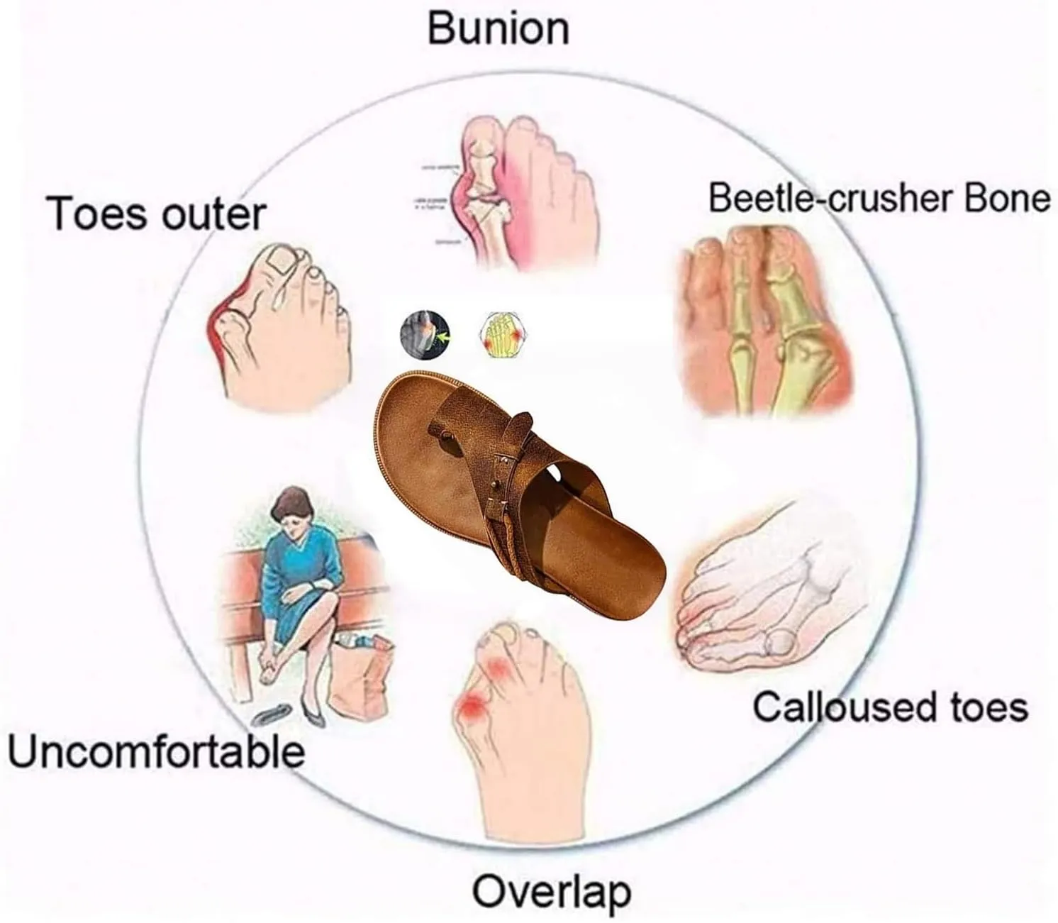 Women Fashion Toe Loop Sandals, Women's Breathable Non-Slip Slip-On Hallux Valgus Clip Toe Sandals, Summer Comfortable Orthopedic Flip-Flop, for Bunion Splints Toe Separator